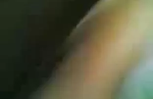 Nhiều lông da đen tr ...